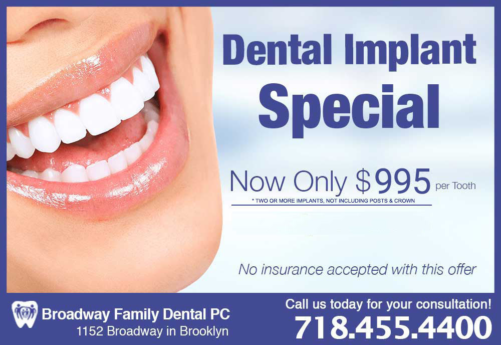 Broadway Family Dental Implant for $995