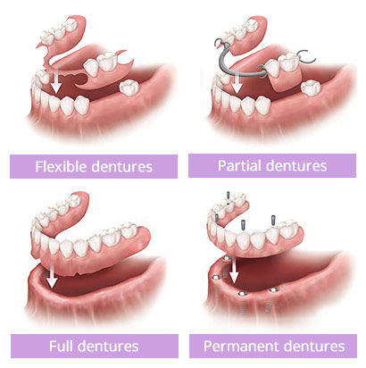 Brooklyn Dentures