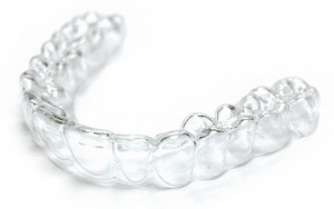 Essix Retainer