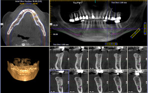 3D Cone Beam Computed Tomography