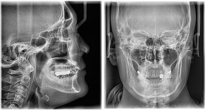 Cephalometric Image