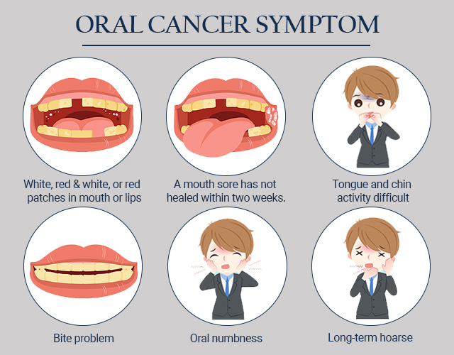 Oral Cancer Symptom