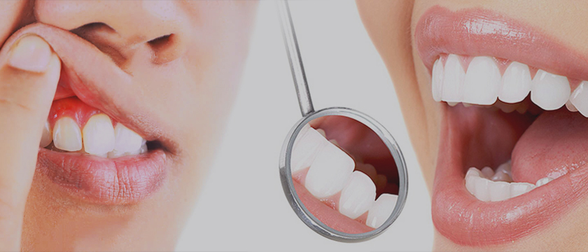 Periodontal Services