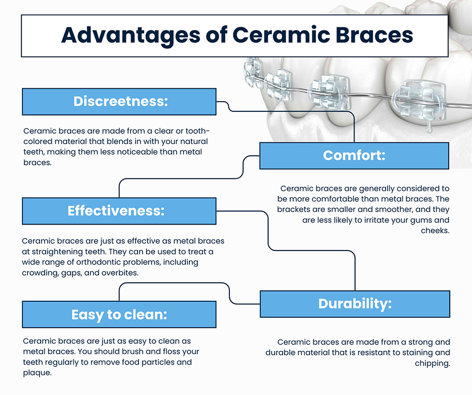 Advantages of Ceramic Braces