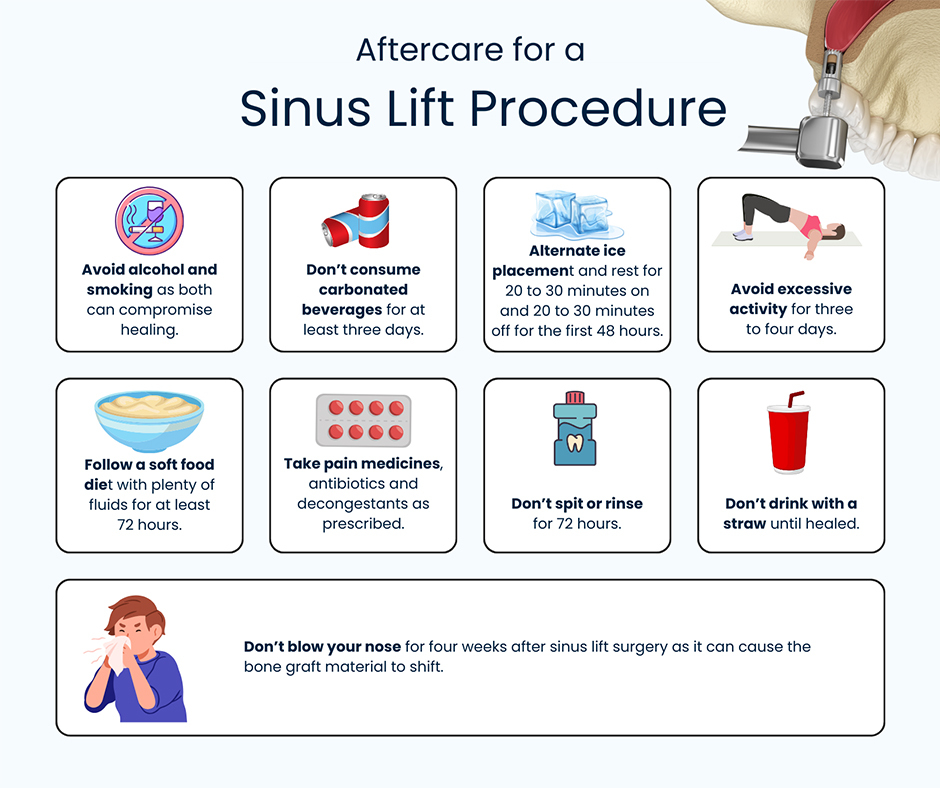 Aftercare for a Sinus Lift Procedure