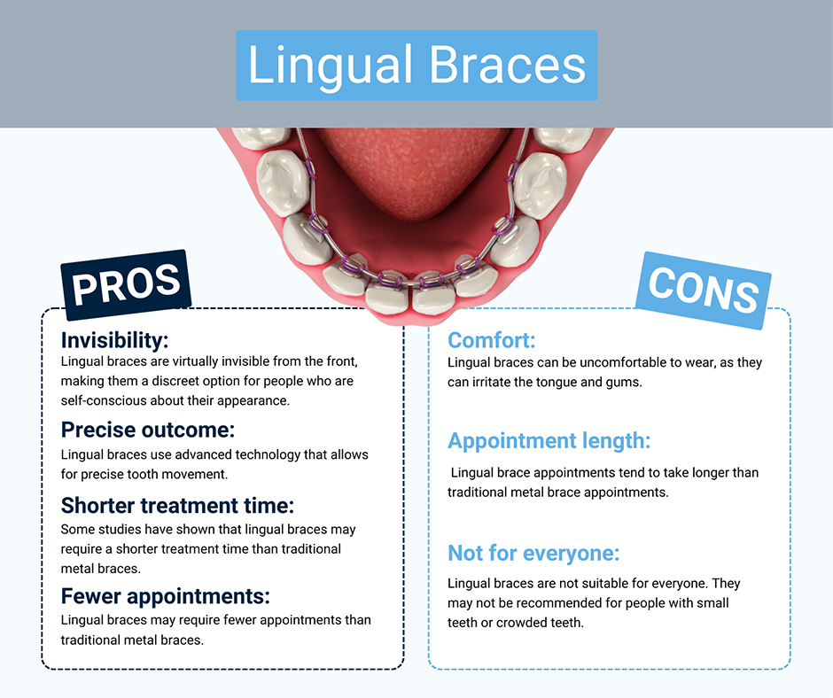 Pros and Cons of Lingual Braces