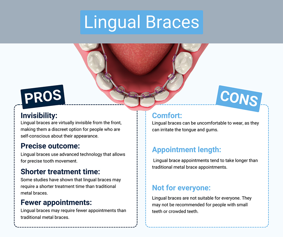 What You Need to Know About Lingual Braces - Brimhall Dental Group