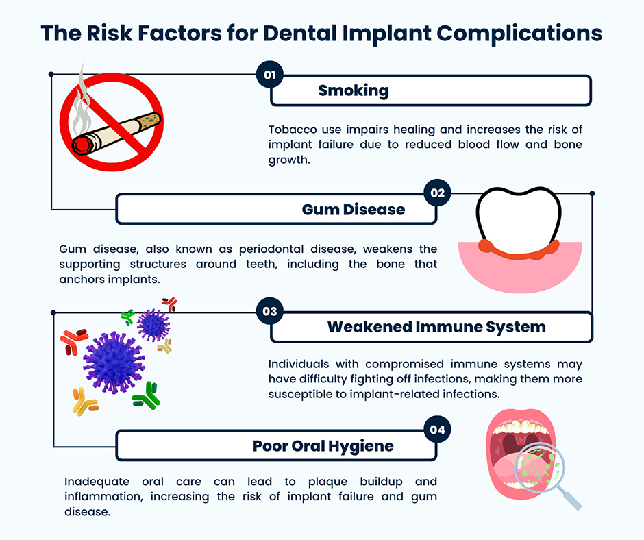 Risk Factors for Dental Implant Complications