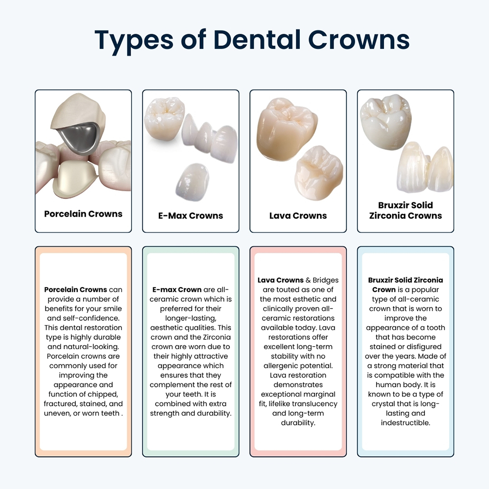 Dental Crowns: Types, Procedure & Care