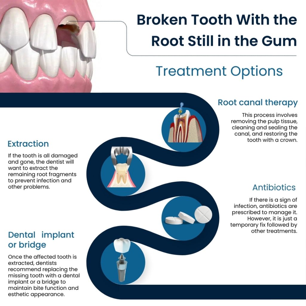 Broken Tooth, Root Still In Gum: What To Do? | Broadway Family Dental