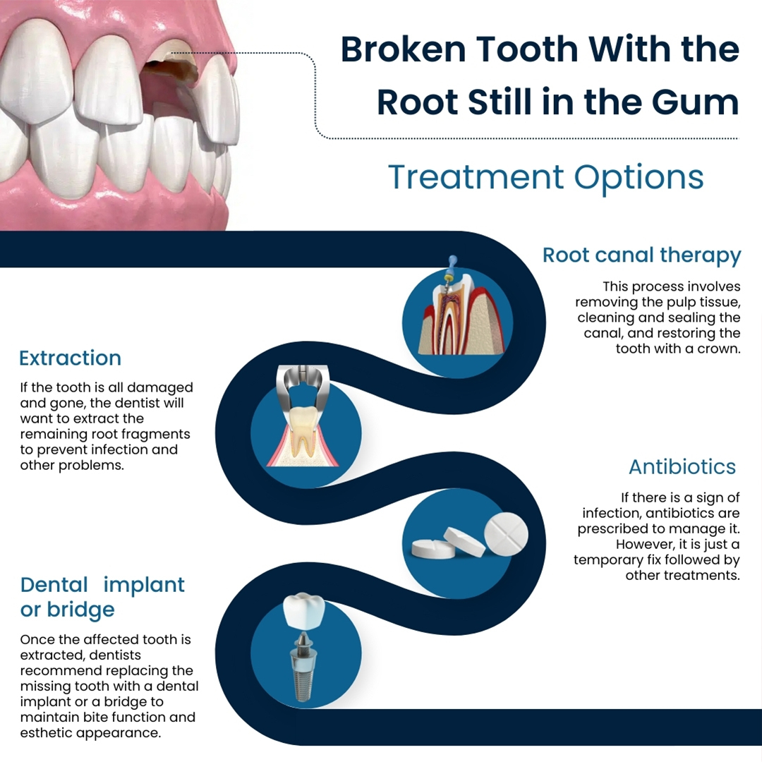 Broken Tooth Root Still in Gum