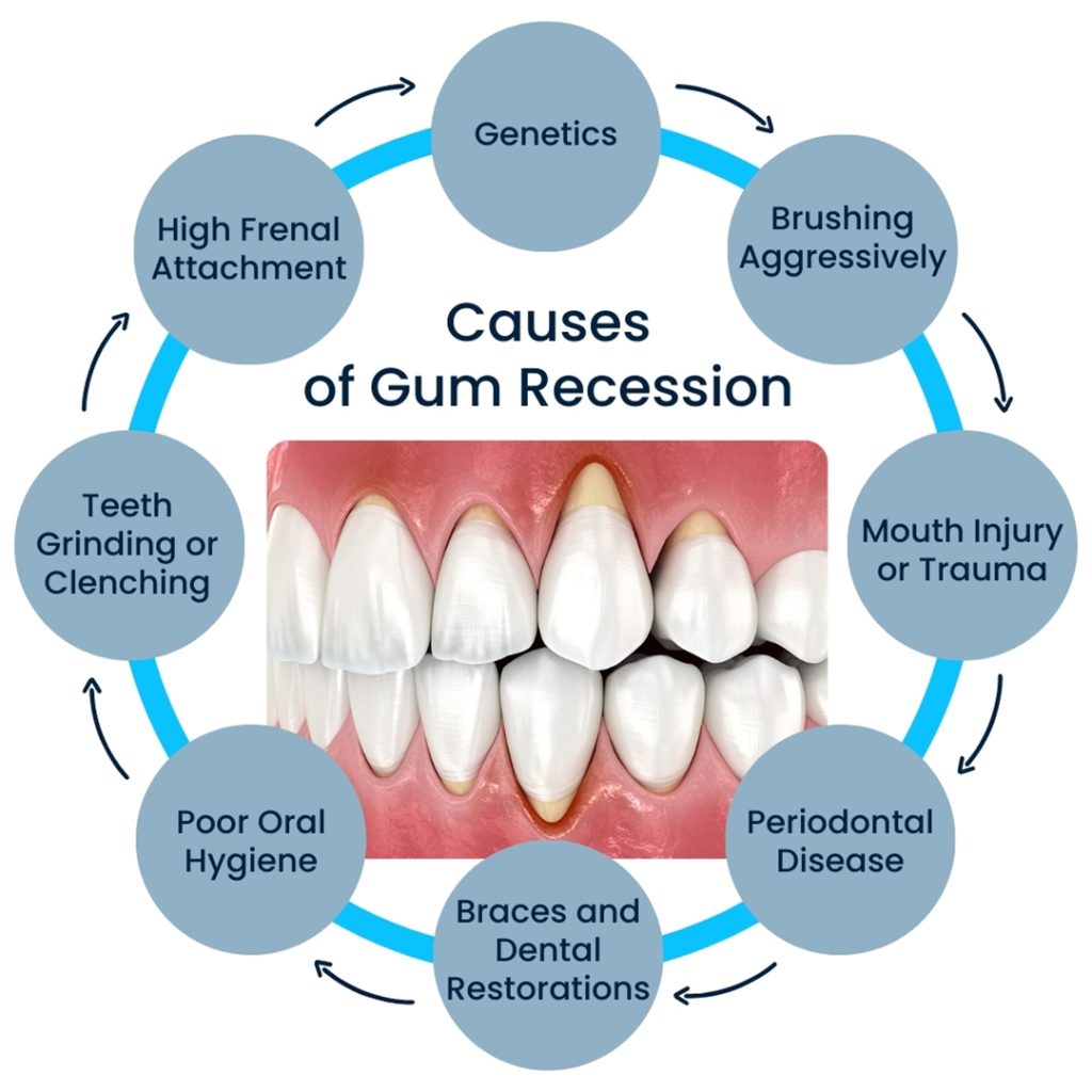 Why Does Gum Dissolve In My Mouth 8 Causes of Gum Recession | Broadway Family and Cosmetic Dentistry