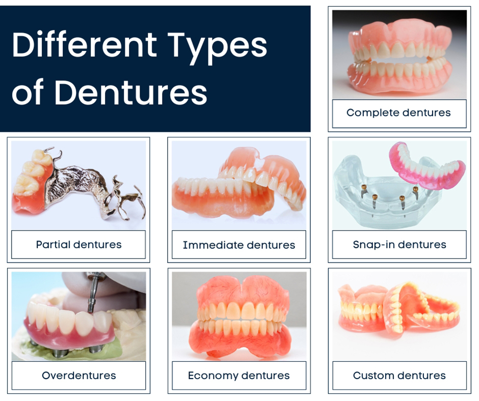 Different Types of Dentures