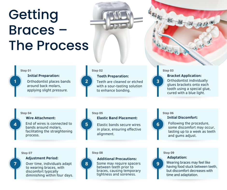 Getting Braces – The Process