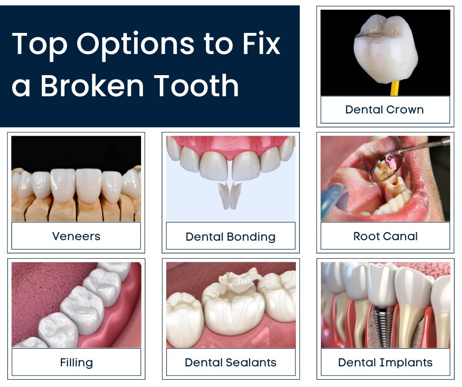 Top Options to Fix a Broken Tooth