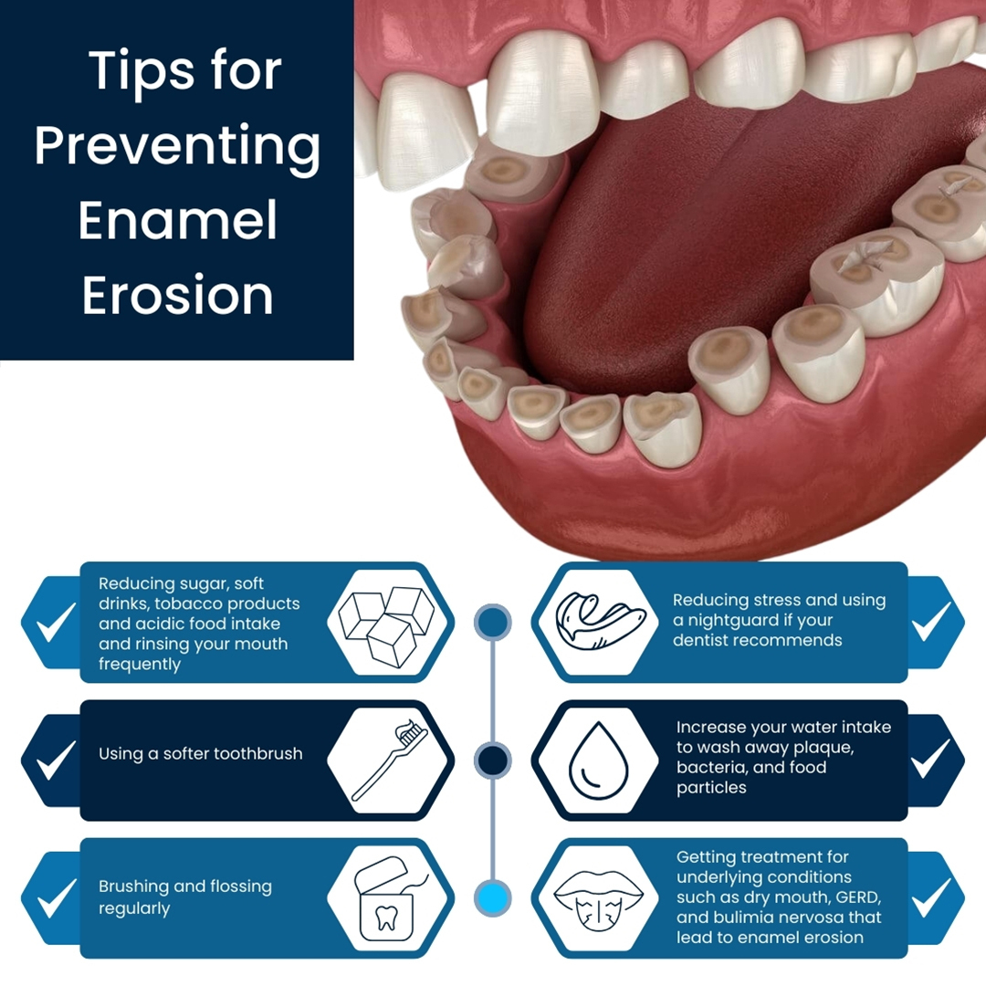 Preventing Enamel Erosion