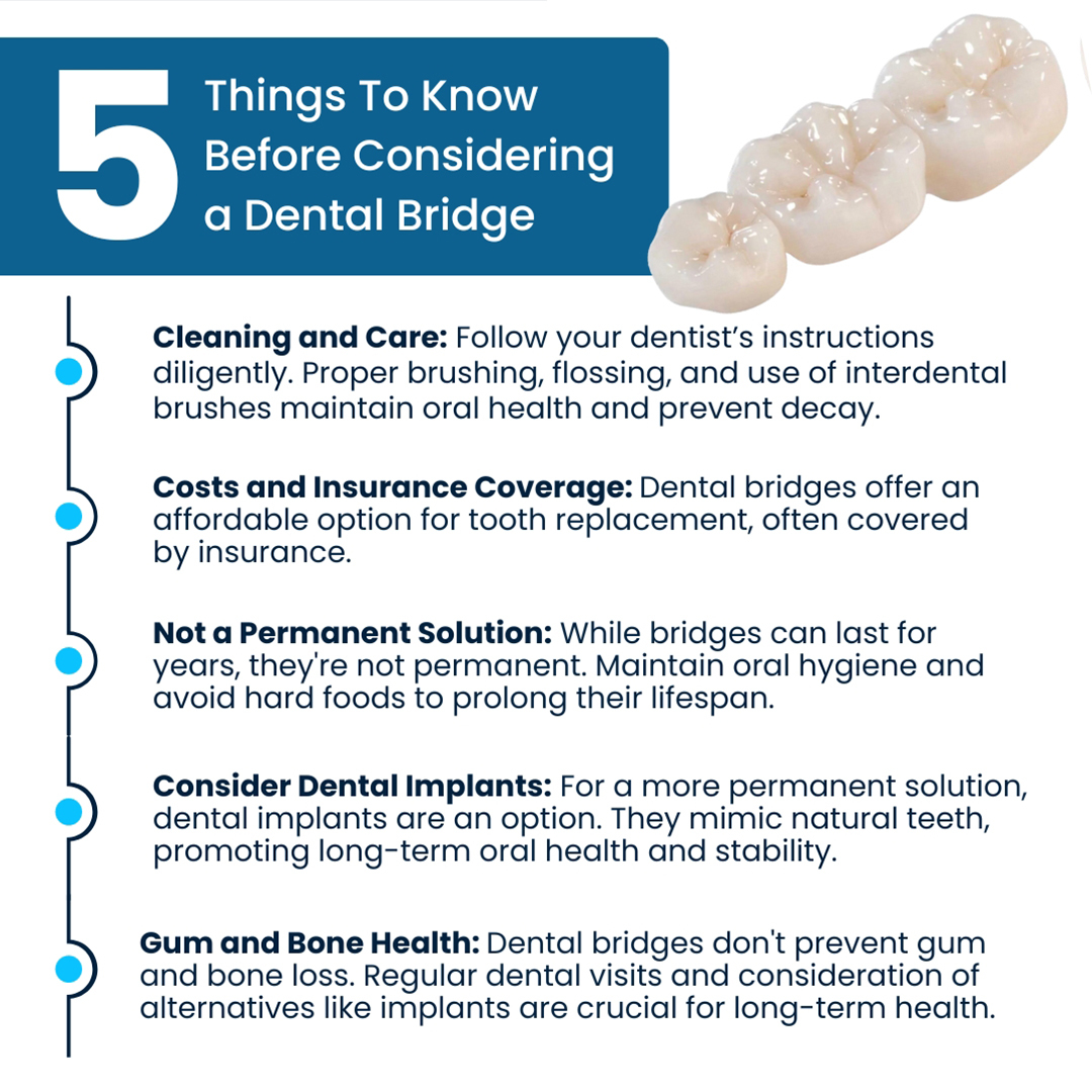 5 Things To Know Before Considering a Dental Bridge