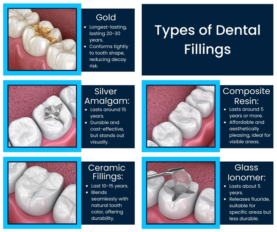 Types of Dental Fillings