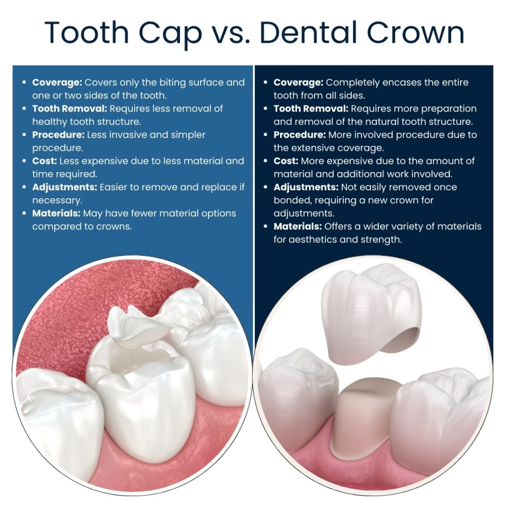 Difference Between A Cap And A Crown Broadway Family Dental