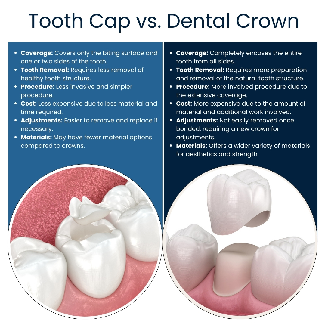 Tooth Caps vs Dental Crowns