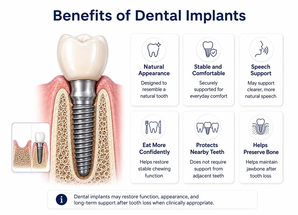 Benefits of Dental Implants Bushwick, Brooklyn