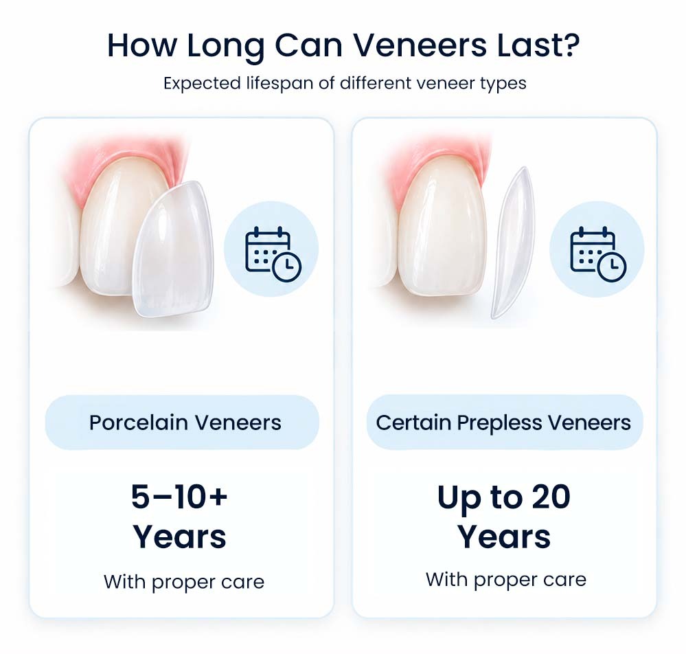 Infographic showing expected lifespan of porcelain veneers and certain prepless veneers